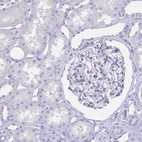 Immunohistochemical staining of human kidney shows no positivity in cells in tubules as expected.
