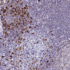 Anti-IL2RA Antibody