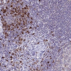 Immunohistochemical staining of human lymph node shows strong membranous positivity in non-germinal center cells.