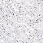 Immunohistochemical staining of human kidney shows weak to moderate nuclear positivity in cells in tubules.