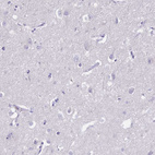 Immunohistochemical staining of human cerebral cortex shows no positivity in neurons as expected.