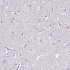 Anti-IL2RA Antibody