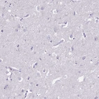 Immunohistochemical staining of human cerebral cortex shows no positivity in neurons as expected.