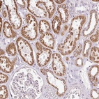 Anti-DAAM2 Antibody