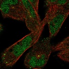 Immunofluorescent staining of human cell line RH-30 shows localization to nucleoplasm & vesicles.