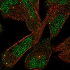 Immunofluorescent staining of human cell line RH-30 shows localization to nucleoplasm & vesicles.
