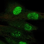 Anti-TERT Antibody