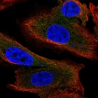 Immunofluorescent staining of human cell line PC-3 shows localization to cytosol.