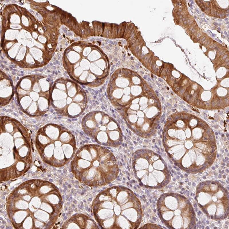 Anti-ZNF394 Antibody