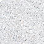 Immunohistochemical staining of human liver shows no positivity in hepatocytes as expected.