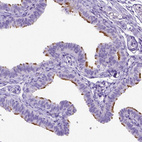 Immunohistochemical staining of human fallopian tube shows strong positivity in cilia in glandular cells.