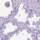 Immunohistochemical staining of human prostate shows no positivity in glandular cells as expected.