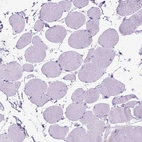 Immunohistochemical staining of human skeletal muscle shows no positivity in myocytes as expected.