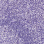 Immunohistochemical staining of human tonsil shows no positivity in non-germinal center cells as expected.