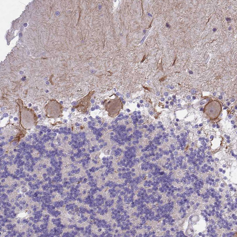 Anti-KCNMA1 Antibody
