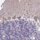 Anti-KCNMA1 Antibody