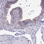 Immunohistochemical staining of human Fallopian tube shows weak membranous positivity in glandular cells.