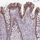 Immunohistochemical staining of human rectum shows moderate membranous positivity in glandular cells.