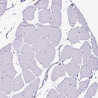 Immunohistochemical staining of human skeletal muscle shows no positivity in myocytes as expected.