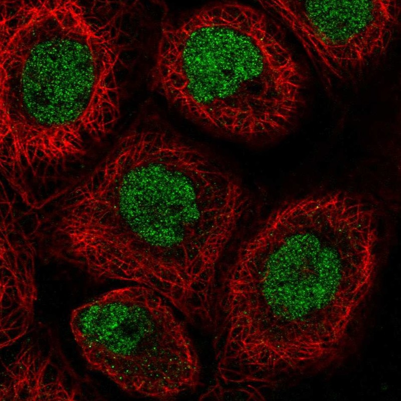 Anti-RLF Antibody