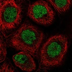 Anti-RLF Antibody