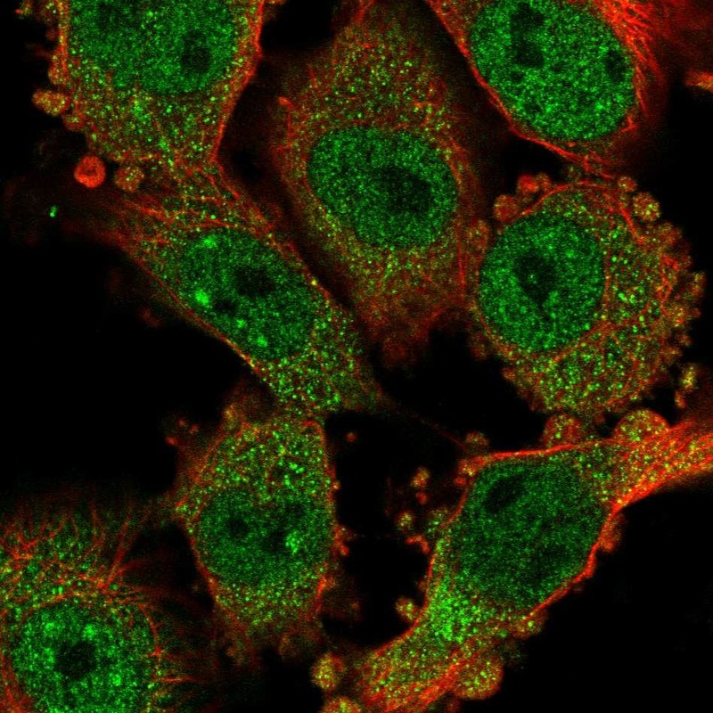 Anti-CCDC159 Antibody