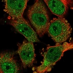 Anti-CCDC159 Antibody
