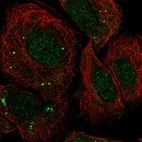 Anti-FOSB Antibody