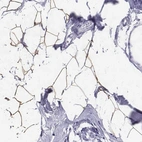 Immunohistochemical staining of human breast shows strong cytoplasmic positivity in adipocytes.