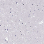Immunohistochemical staining of human cerebral cortex shows no positivity in neurons as expected.