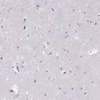 Immunohistochemical staining of human cerebral cortex shows no positivity in neurons as expected.