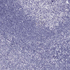 Immunohistochemical staining of human tonsil shows no positivity in non-germinal center cells as expected.