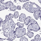 Immunohistochemical staining of human placenta shows no positivity in trophoblastic cells as expected.
