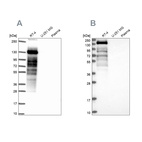 Western blot analysis using Anti-PLIN4 antibody HPA054657 (A) shows similar pattern to independent antibody HPA044682 (B).