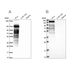 Western blot analysis using Anti-PLIN4 antibody HPA054657 (A) shows similar pattern to independent antibody HPA044682 (B).