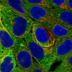 Immunofluorescent staining of human cell line RT4 shows localization to cytosol & lipid droplets.