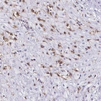 Immunohistochemical staining of human placenta shows high expression.