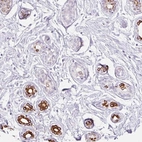 Anti-IRX2 Antibody