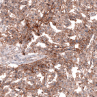 Anti-TNFRSF8 Antibody