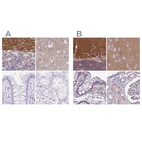 Immunohistochemical staining of human cerebellum, cerebral cortex, colon and kidney using Anti-SLC8A2 antibody HPA054671 (A) shows similar protein distribution across tissues to independent antibody HPA050818 (B).