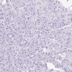 Immunohistochemical staining of human pancreas shows low expression as expected.