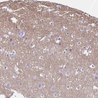 Immunohistochemical staining of human cerebral cortex shows high expression.
