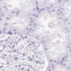 Immunohistochemical staining of human kidney using Anti-SLC8A2 antibody HPA054671.