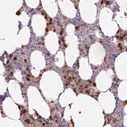Anti-TDRD15 Antibody