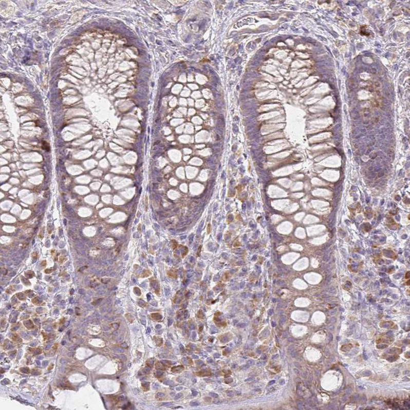 Anti-BRINP3 Antibody