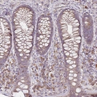 Anti-BRINP3 Antibody