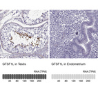Anti-GTSF1L Antibody