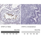 Anti-GTSF1L Antibody