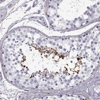 Immunohistochemical staining of human testis shows high expression.