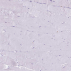 Immunohistochemical staining of human skeletal muscle shows no positivity in myocytes as expected.